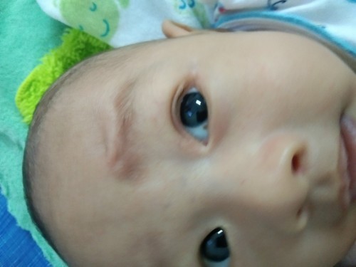 ฝุ่นเข้าตา