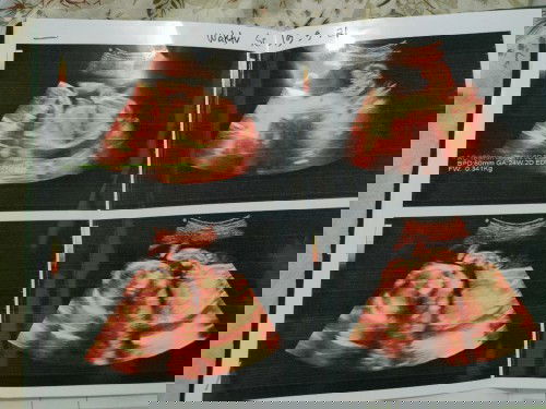 Bun.bantu saya dung ad yg senasipkah dgn saya