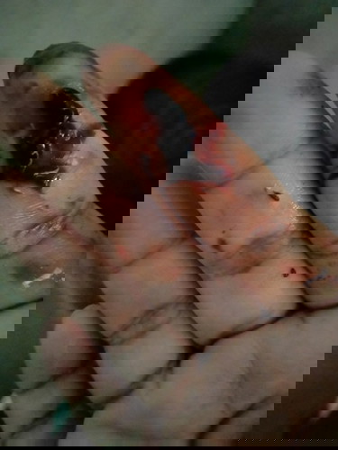 มีคุณแม่คนไหนเคยเป็นแบบนี้บ้างต้องไปหาหมอไหม