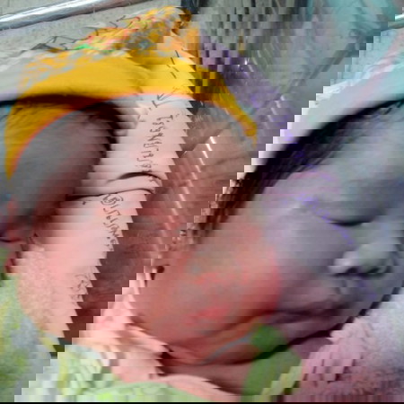 เด็กผ่าคลอด 4540g