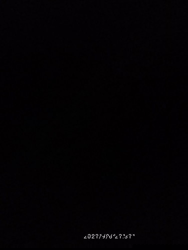 Sakit gigi di saat hamil, apakah itu termasuk efek dari kehamilan...?
Bantu jawab ya bunda/moms...
