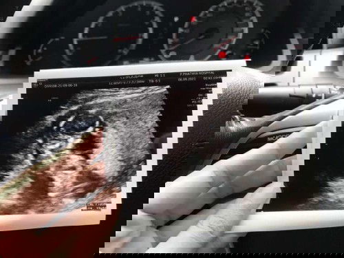 เจ้าก้อนของแม่แม่ 💗