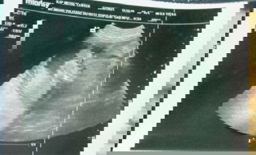 Hasil USG nya jelas ga??