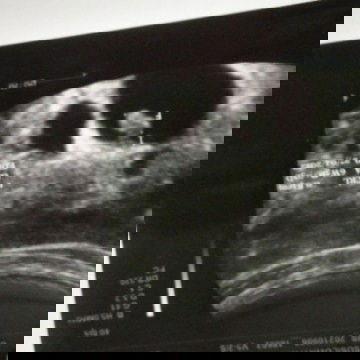 Perkataan Dokter yang bikin worry.