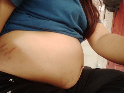 31สัปดาห์6วัน