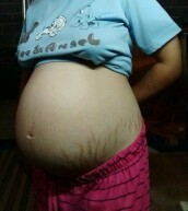 36+6แล้วค่ะท้องลายมาก
เข้าเดือนที่9แล้วมีคนทักว่าท้องเล็กมันเล็กจริงๆหรอคะไอ้เราก็กังวลคิดมาก