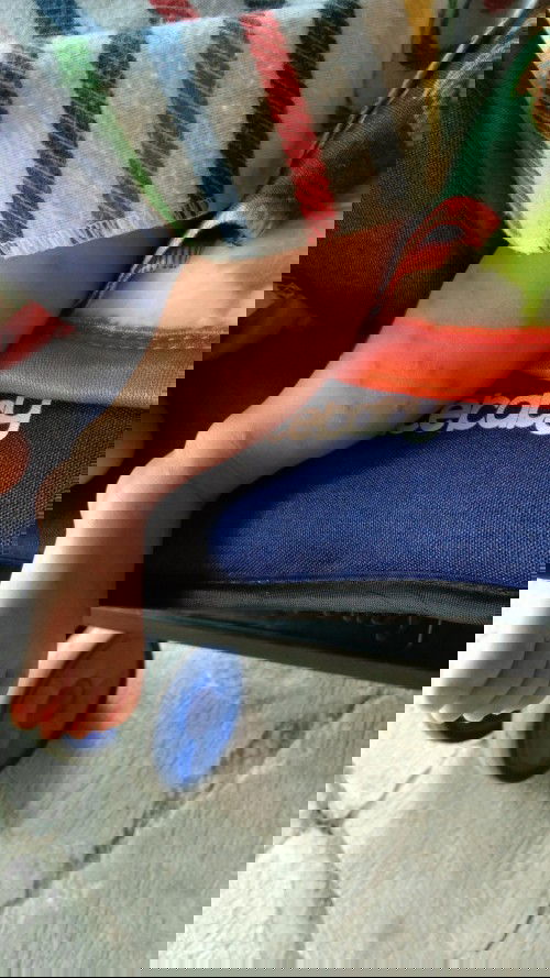 Bintik pada kaki dan tangan