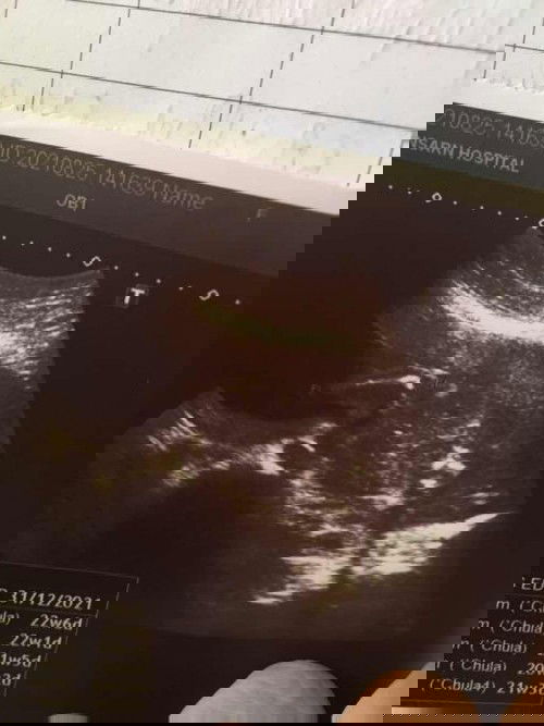 คือส่วนไหนของน้องคะ