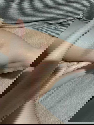 What kind of insects bite is this