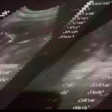 kehamilan turun terus. apakah pernah ada yg ngalamin kaya saya