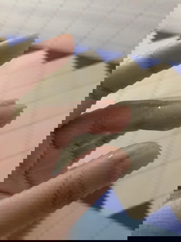 สอบถามประสบการณ์ใกล้คลอด