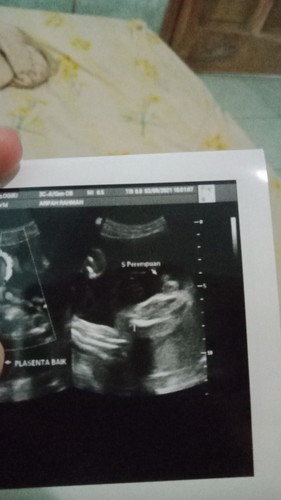 Jenis kelamin anak