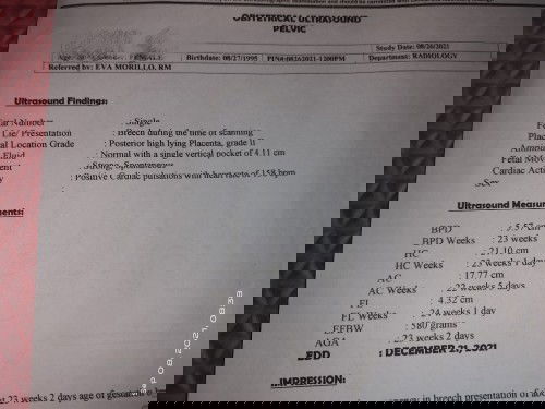 Sobrang nagugulahan na talaga ako mga mamsh pa advice naman,!