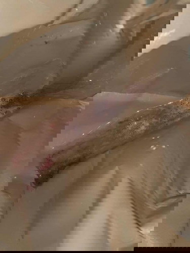 ใช่อาการกรดไหลย้อนมั้ยคะ