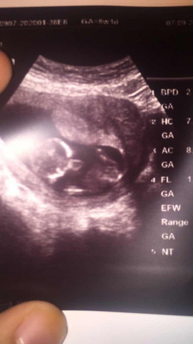 saya tidak tahu cara mengira bulanan bayi dalam kandungan