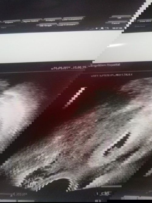 ใช้น้องกรือเปล้าา