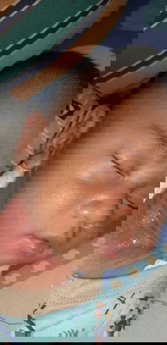Mau minta bantu jawab bun,anak aku sedang mengalami biang keringat,obat yang bagus dan aman apa ya?