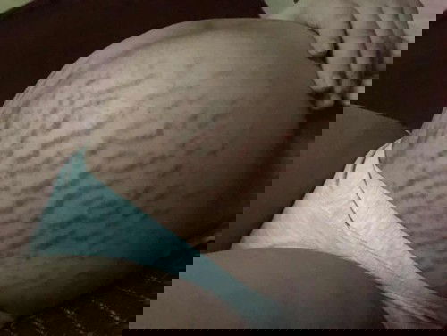 Có mom nào rạn nhiều như em k ạ?