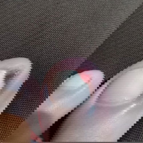 Cantengan dijarijempol