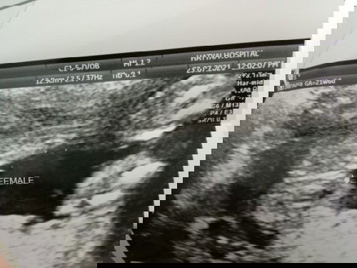 แม่ๆว่าแบบนี้ผู้หญิง100%มั้ยค่ะ