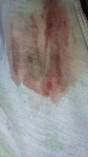 Pasintabi po Tanong ko lang kung normal lang ba to nagka brown discharge ako kanina morning,2mnthprg