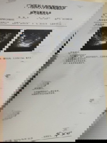 มีลุ้นว่าน้องจะติดไหมคะ