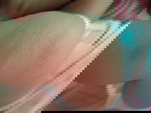 สอบถามแม่ๆหน่อยค่ะ ตุ่มที่ขึ้น ตรงเข่าน้อง มันคือตุ่มอะไรคะ