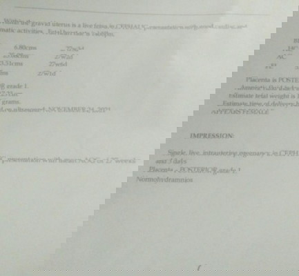 Confusing , My LMP was January 17 ,so I'm expected my EDD was October 24, Bakit sa utz NOVEMBER 24?