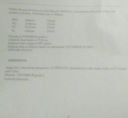 Confusing , My LMP was January 17 ,so I'm expected my EDD was October 24, Bakit sa utz NOVEMBER 24?