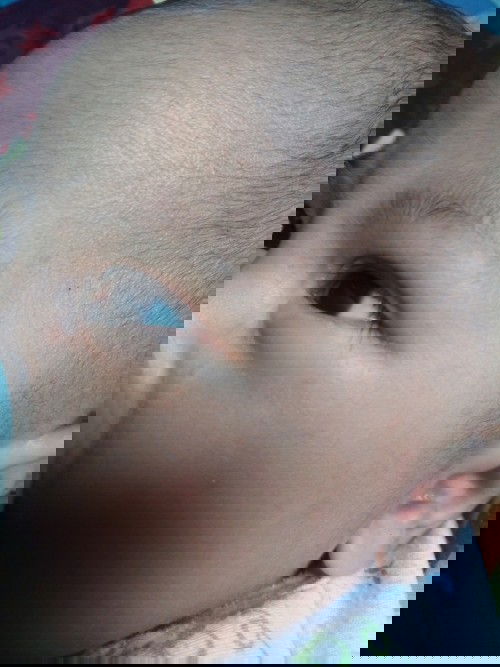 Di samping mata ada putih2