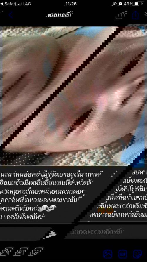 ผดผื่น ลูกน้อย