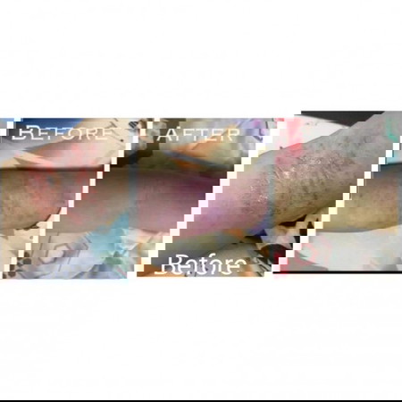 6 years of Eczema Challenges with the little one!