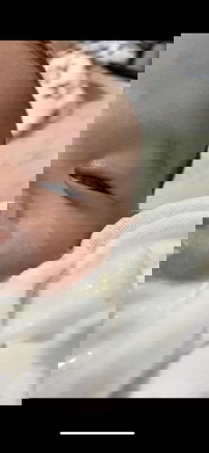 My baby vomits everyday