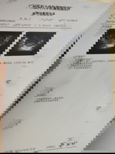 แบบนี้มีลุ้นว่าน้องมาแล้วใช่ไหมคะ