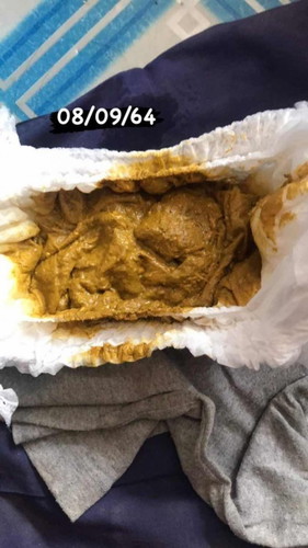 ? เด็กถ่ายตัวมีด้วยหรอ ?