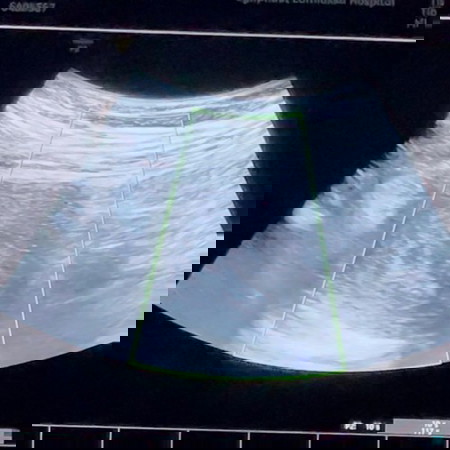 ความรู้สึกของคนกำลังจะเป็นแม่