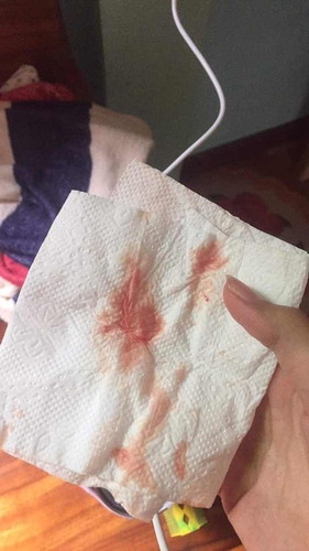 สอบถามแม่ๆหน่อยค่ะ