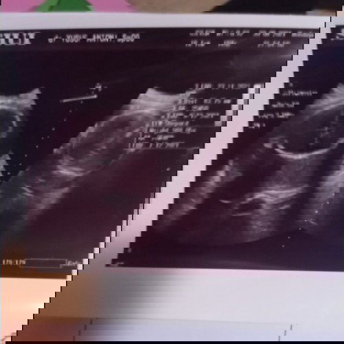 Bun Mau tanya vaksin buat bumil apa di haruskan ya bun 🙏🏻