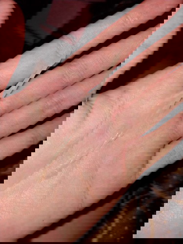 สอบถามแม่ๆท้อง34kw