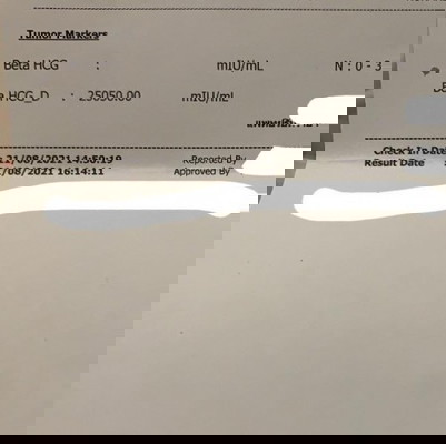 ค่า hcg สูงมีโอกาสแฝดไหม
