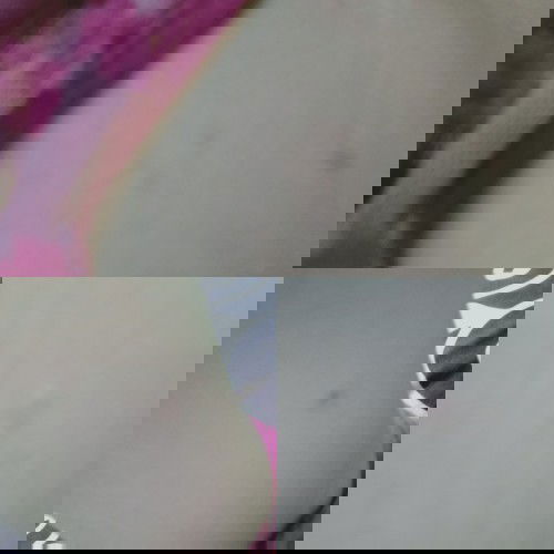 Keluar bintik merah dan gatal