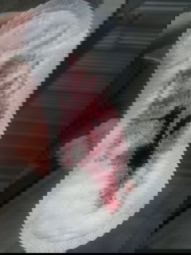 Spotting? Miscarriage