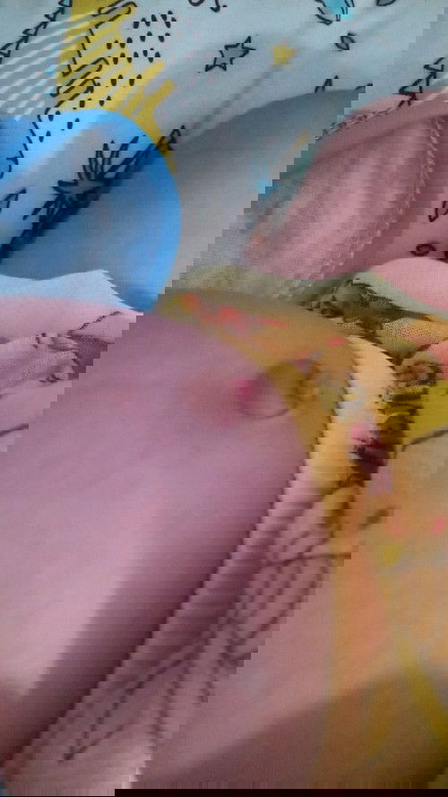 Pusar belum kering dan ada benjolan