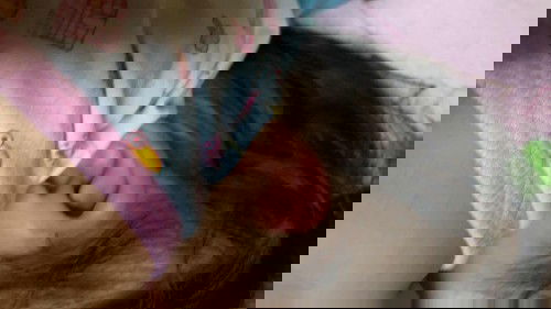 หูแดงบวม ไม่ทราบว่าใช้อะไรทาได้บ้าง