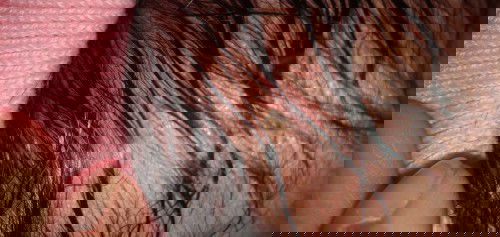 Muncul bintik bernanah di kepala bayi