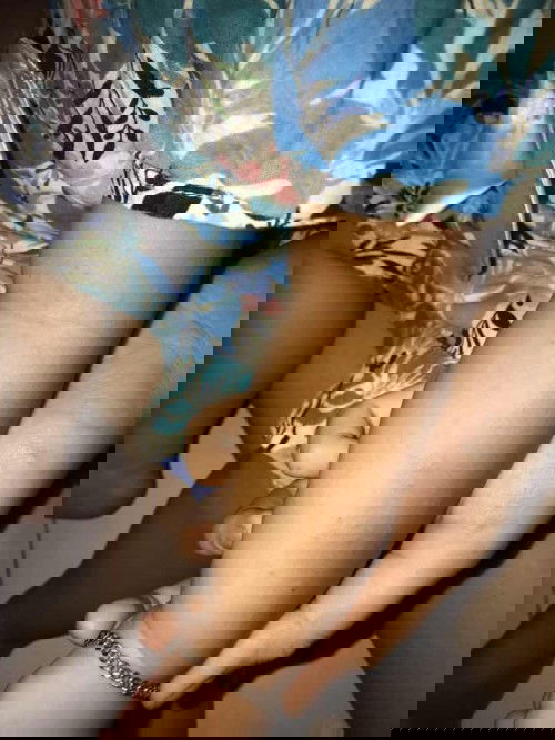 Gatal pada tangan anak