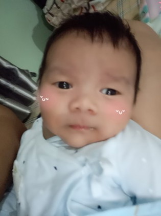 ลูกถ่ายบ่อยจะเป็นอะไรไหมค่ะตอนนี้น้องได้1เดือนแร้วค่ะ