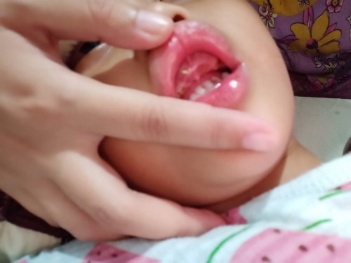 Gigi tumbuh usia berapa?