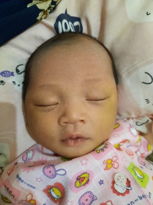 Bintik2 diwajah