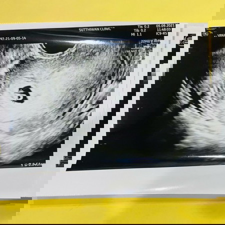 ช่วยแนะนำด้วยนะคะ